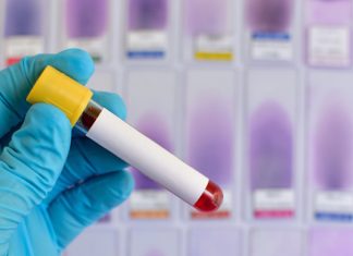 14 paesi a rischio Zika virus. Cos’è la nuova minaccia sanitaria mondiale