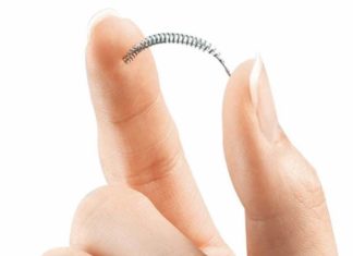 Essure, la Fda ordina a Bayer di bloccare la vendita
