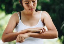 Psoriasi, 5 cose da sapere sulla malattia della pelle più comune tra i giovani