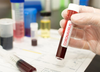 Coronavirus, smentito caso sospetto a Napoli, contagi anche in Francia