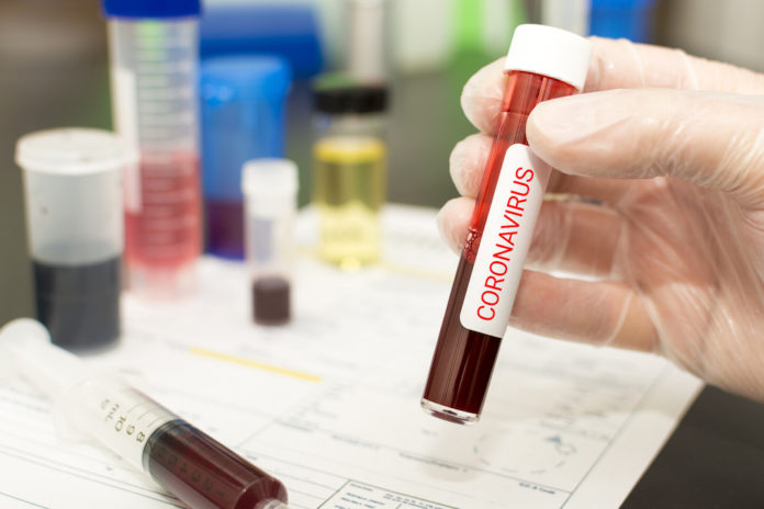 Close up of Coronavirus, blood in a test tube