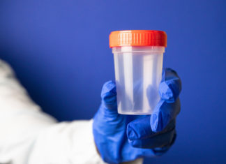 Esame delle urine: come si svolge, quali sono i valori standard e come prepararsi ESAME DELLE URINE