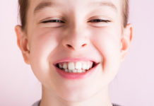 Cosa significano le macchie bianche sui denti del bambino? MACCHIE BIANCHE DENTI BAMBINI