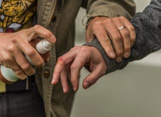 Troppe allergie da clorexidina, l’allerta francese CLOREXIDINA