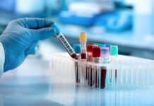 Le analisi in farmacia sono affidabili? Dopo i dubbi di Gabanelli quelli dei medici di base analisi