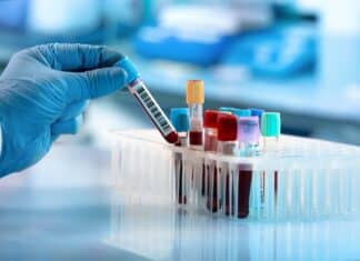 Le analisi in farmacia sono affidabili? Dopo i dubbi di Gabanelli quelli dei medici di base analisi