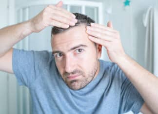 Alopecia, i farmaci per curarla portano pensieri suicidari