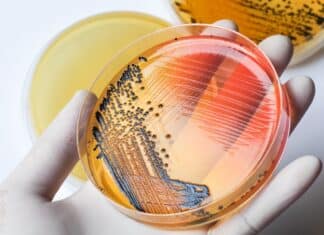 Salmonella a Reggio Emilia: oltre 60 casi sospetti SALMONELLA