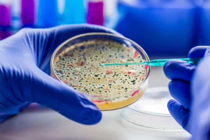 Medical diagnostic laboratory. Culture of microbiological material in a microbiological laboratory. microrganismi