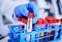 Legionella in aumento: oltre 10 casi al giorno in Italia nel 2024 LEGIONELLA