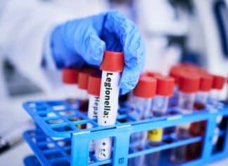 Legionella in aumento: oltre 10 casi al giorno in Italia nel 2024 LEGIONELLA